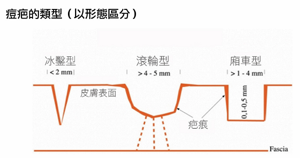 全方位痘疤_塔羅牌老師雷洛斯