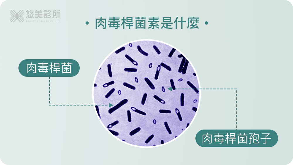 打肉毒桿菌多少錢/品牌/部位效果2024更新版_悠美診所