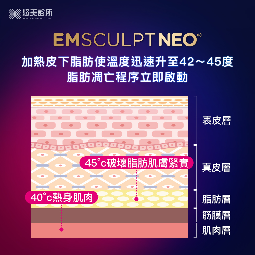 EMSCULPTNEO熱磁減脂_悠美診所