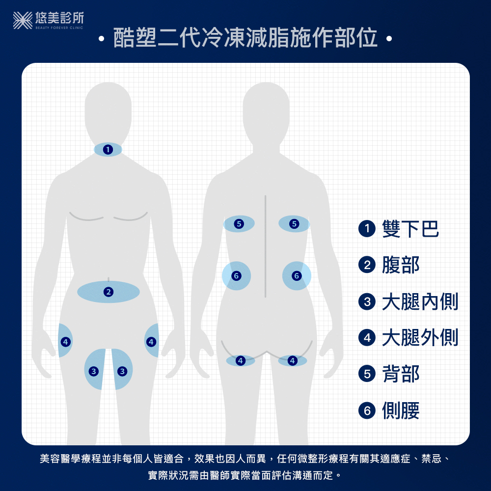 爆夯的酷塑二代冷凍減脂施作部位