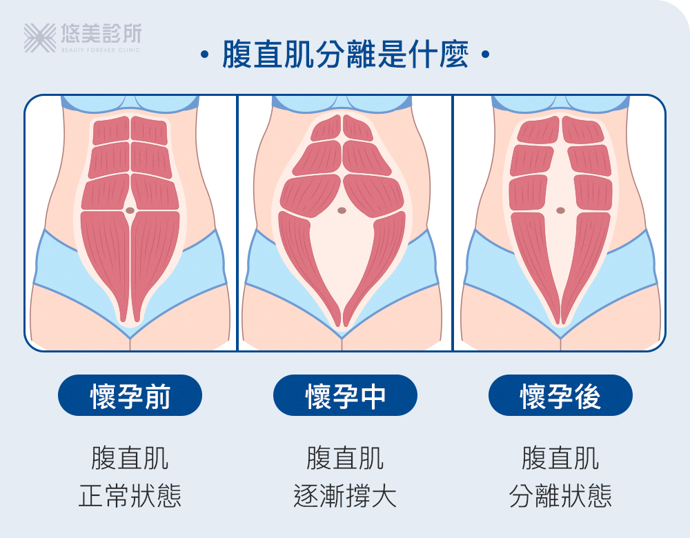 EMBODY核心美力_悠美診所