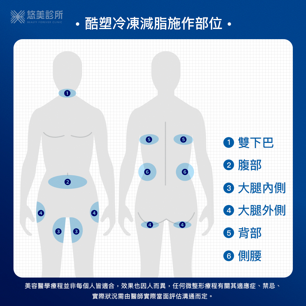 酷塑冷凍減脂效果