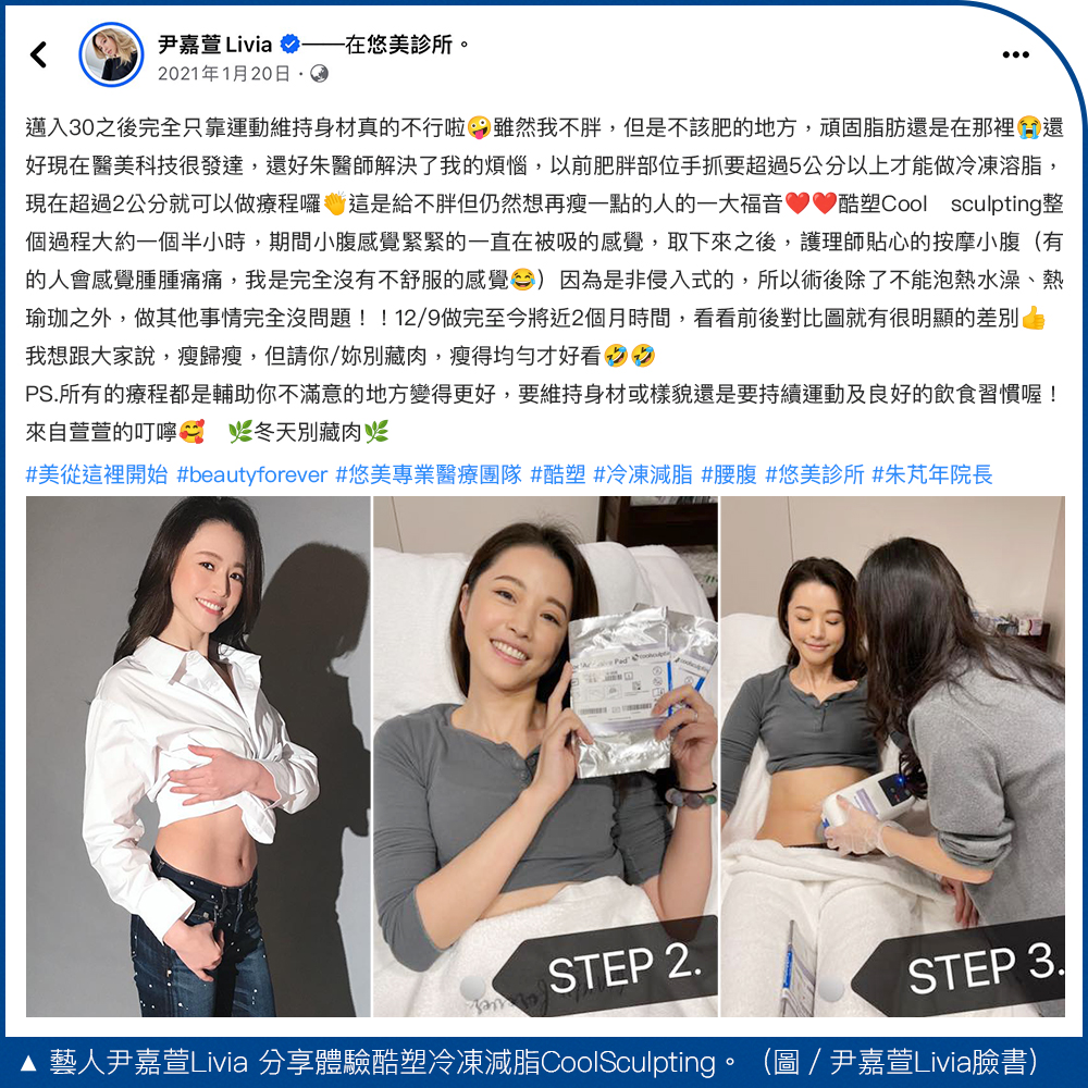 酷塑冷凍減脂CoolSculpting-藝人心得案例分享