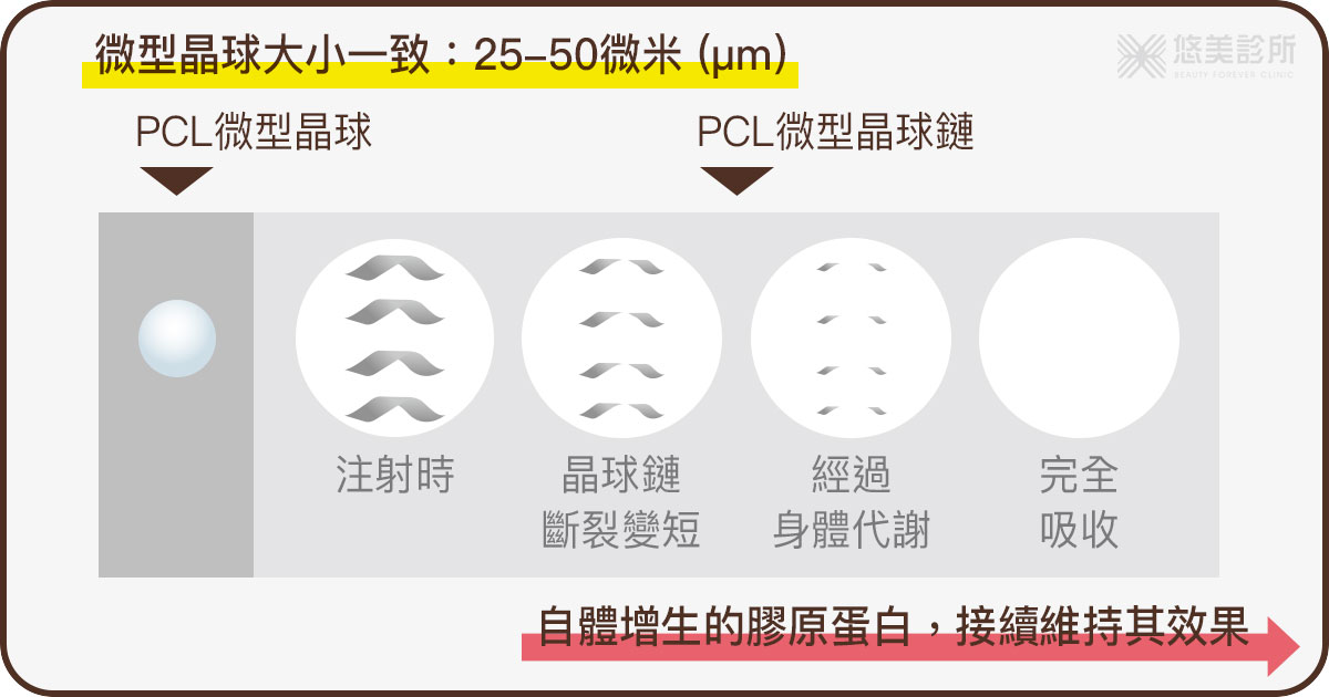 為何洢蓮絲Ellanse植入劑能增生膠原蛋白-悠美診所